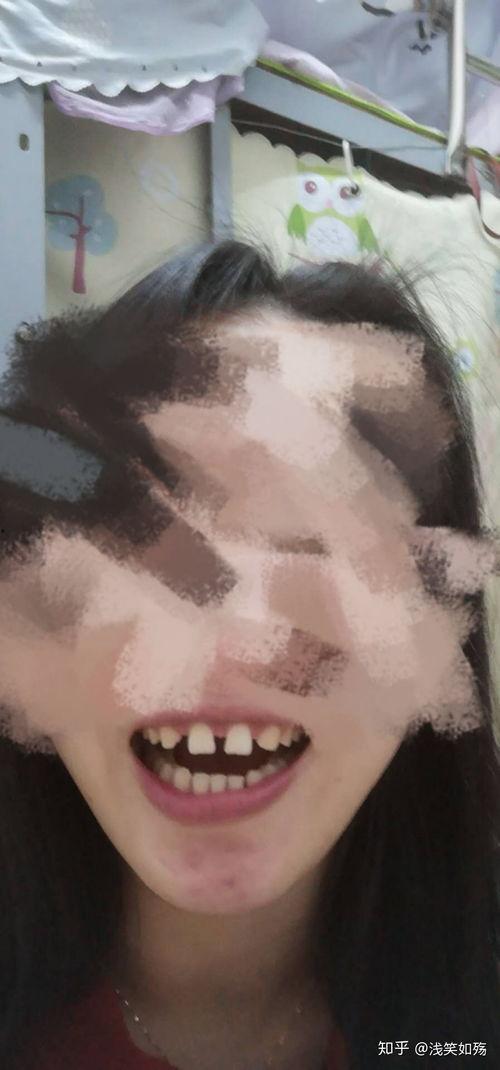 成人掉大牙还能长吗视频,还能否重获新生？