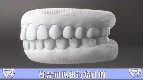 成人牙齿还会修复吗视频,揭秘牙齿再生的秘密