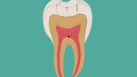 成人牙齿还会修复吗视频,揭秘牙齿再生的秘密