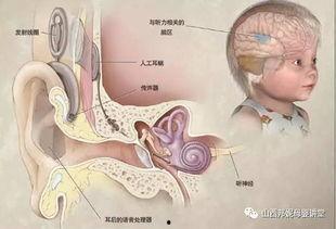 成人耳蜗更换视频大全,视频大全深度解析